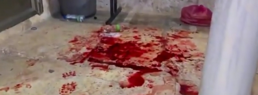 الدماء تغطي الأرضية داخل المسجد الأقصى .. صور